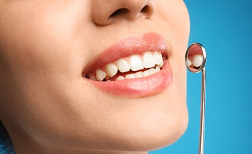 Nose-to-chin view of woman smiling with dental mirror next to teeth in front of blue background